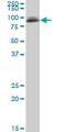 Phosphatidylinositol Glycan Anchor Biosynthesis Class S antibody, MA5-24508, Invitrogen Antibodies, Western Blot image 