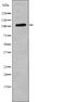 Colony Stimulating Factor 1 Receptor antibody, PA5-64778, Invitrogen Antibodies, Western Blot image 