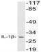 Interleukin 1 Beta antibody, NBP1-19775, Novus Biologicals, Western Blot image 