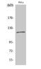 BUB1 Mitotic Checkpoint Serine/Threonine Kinase B antibody, STJ91914, St John