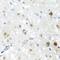 Scaffold Attachment Factor B2 antibody, orb373214, Biorbyt, Immunohistochemistry paraffin image 