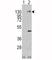 Platelet Derived Growth Factor Receptor Alpha antibody, F50655-0.4ML, NSJ Bioreagents, Western Blot image 