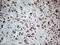 FTO Alpha-Ketoglutarate Dependent Dioxygenase antibody, M00219-1, Boster Biological Technology, Immunohistochemistry paraffin image 