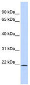 Scm Polycomb Group Protein Like 1 antibody, TA343634, Origene, Western Blot image 