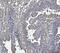 Major Histocompatibility Complex, Class II, DR Alpha antibody, M01195-4, Boster Biological Technology, Immunohistochemistry paraffin image 
