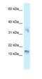 Urp antibody, NBP1-79927, Novus Biologicals, Western Blot image 