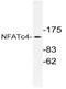 Nuclear factor of activated T-cells, cytoplasmic 4 antibody, AP21139PU-N, Origene, Western Blot image 