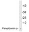 Parvalbumin antibody, LS-B11425, Lifespan Biosciences, Western Blot image 