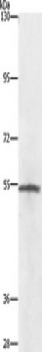 NIMA Related Kinase 2 antibody, TA349610, Origene, Western Blot image 