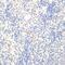 FOXP3 antibody, GTX64343, GeneTex, Immunohistochemistry paraffin image 