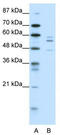 Paired Box 6 antibody, TA335202, Origene, Western Blot image 