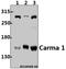 Caspase Recruitment Domain Family Member 11 antibody, A00740-1, Boster Biological Technology, Western Blot image 
