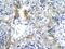 DNA Topoisomerase II Alpha antibody, GTX77787, GeneTex, Immunohistochemistry paraffin image 