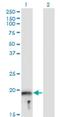 Myosin Light Chain, Phosphorylatable, Fast Skeletal Muscle antibody, H00029895-M05, Novus Biologicals, Western Blot image 