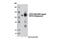 Ubiquitin Specific Peptidase 10 antibody, 8501P, Cell Signaling Technology, Western Blot image 