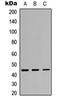 Interleukin 3 Receptor Subunit Alpha antibody, orb234793, Biorbyt, Western Blot image 