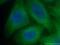 alpha-Tubulin antibody, YF488-66031, Proteintech Group, Immunofluorescence image 