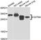 Glutathione S-Transferase Mu 4 antibody, STJ29570, St John