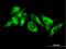 Acyl-CoA Synthetase Long Chain Family Member 3 antibody, H00002181-B01P, Novus Biologicals, Immunocytochemistry image 
