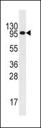 Colony Stimulating Factor 2 Receptor Beta Common Subunit antibody, LS-C100169, Lifespan Biosciences, Western Blot image 