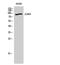 Protein Kinase CGMP-Dependent 2 antibody, GTX34143, GeneTex, Western Blot image 