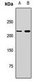 Dicer 1, Ribonuclease III antibody, LS-C668518, Lifespan Biosciences, Western Blot image 