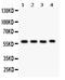 Cytochrome P450 Family 1 Subfamily A Member 1 antibody, PB9544, Boster Biological Technology, Western Blot image 