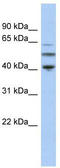 Tubulin alpha-3C/D chain antibody, TA335701, Origene, Western Blot image 