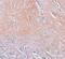 CXXC Finger Protein 5 antibody, PA5-21080, Invitrogen Antibodies, Immunohistochemistry frozen image 