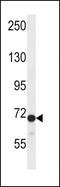 Dishevelled Segment Polarity Protein 2 antibody, 58-081, ProSci, Western Blot image 