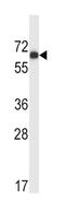 Megakaryocyte-Associated Tyrosine Kinase antibody, abx033640, Abbexa, Western Blot image 