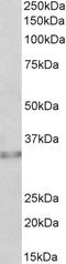 Caspase 6 antibody, LS-C204983, Lifespan Biosciences, Western Blot image 