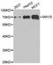 Mitochondrial Antiviral Signaling Protein antibody, TA332896, Origene, Western Blot image 