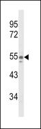 Nicotinamide Phosphoribosyltransferase antibody, 63-743, ProSci, Western Blot image 