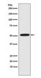 ETS Transcription Factor ERG antibody, M00793, Boster Biological Technology, Western Blot image 