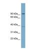 Radial Spoke Head 14 Homolog antibody, NBP1-56493, Novus Biologicals, Western Blot image 