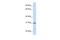 Nucleolar And Spindle Associated Protein 1 antibody, PA5-42841, Invitrogen Antibodies, Western Blot image 