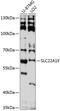 Solute Carrier Family 22 Member 15 antibody, 15-525, ProSci, Western Blot image 