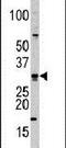 Cell Division Cycle Associated 8 antibody, PA5-11506, Invitrogen Antibodies, Western Blot image 