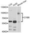 Cytochrome B-245 Beta Chain antibody, LS-C747530, Lifespan Biosciences, Western Blot image 
