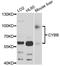 Cytochrome B-245 Beta Chain antibody, LS-C747530, Lifespan Biosciences, Western Blot image 