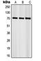 Ribosomal Protein S6 Kinase B1 antibody, MBS820354, MyBioSource, Western Blot image 