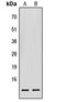 Protein translation factor SUI1 homolog antibody, LS-C356008, Lifespan Biosciences, Western Blot image 