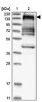 Afadin, Adherens Junction Formation Factor antibody, NBP1-90219, Novus Biologicals, Western Blot image 