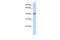 Leucine Rich Repeat Containing 2 antibody, GTX46991, GeneTex, Western Blot image 
