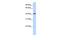 Leucine Rich Repeat Containing 2 antibody, GTX46991, GeneTex, Western Blot image 