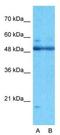 AT-Rich Interaction Domain 5A antibody, NBP1-79440, Novus Biologicals, Western Blot image 