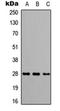 Complement Factor D antibody, orb234752, Biorbyt, Western Blot image 
