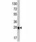 Autophagy Related 12 antibody, F40210-0.4ML, NSJ Bioreagents, Western Blot image 