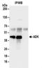 Adenosine Kinase antibody, NBP2-32189, Novus Biologicals, Immunoprecipitation image 